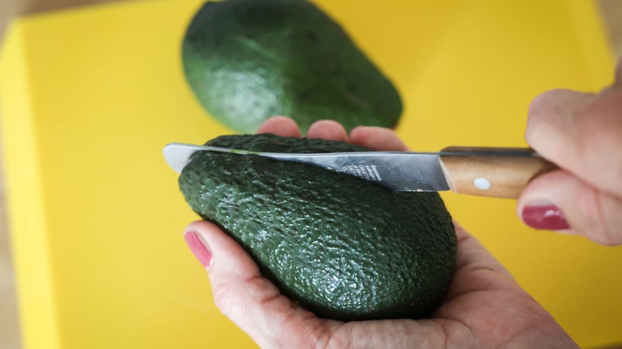 Emergency admission data: "Avocado hand" cases rising - More women affected
