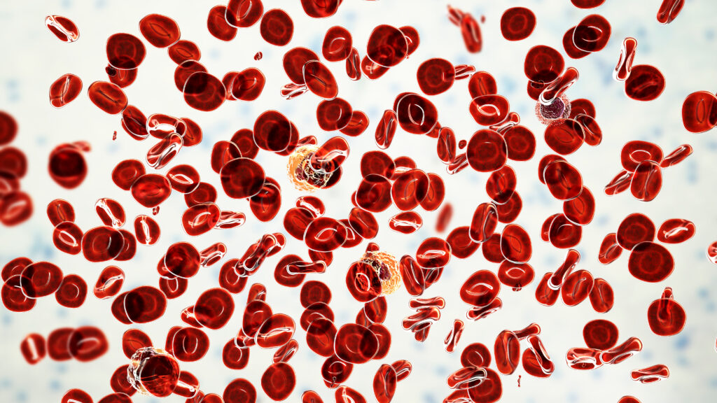 STAT+: Silence Therapeutics aims at Takeda with new data in rare blood cancer