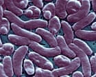 Louisiana warns beachgoers amid surge in flesh-eating bacteria infections