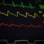 Positive data revealed for patients with a heart attack and multivessel disease