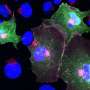 Solving a mysterious inflammatory fever opens the book on a much bigger story