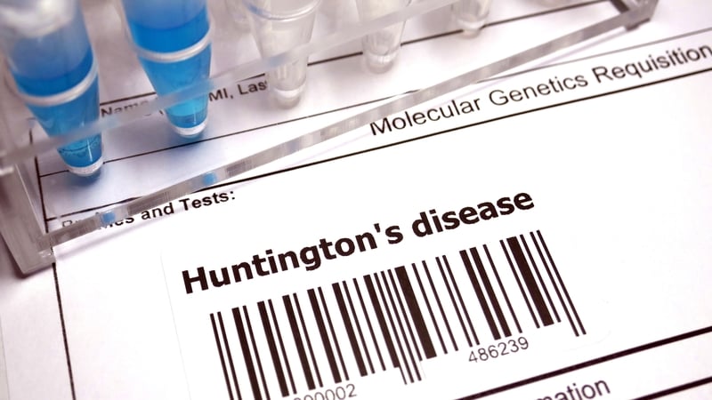Call for HSE to implement care pathway for Huntington's
