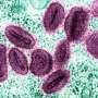 A full-control strategy could cut simulated mpox infections by 97.8%, suggests mathematical model
