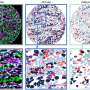 AI model maps tumor tissue to improve cancer care