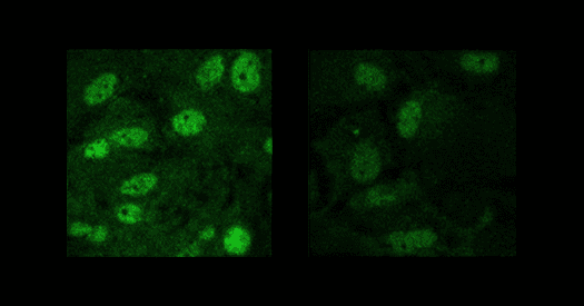 Three models, three routes to altered auditory processing, and more