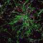 How the developing human brain takes instructions: Two studies reveal what guides its most important stem cells