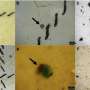 Patients diagnosed with lung cancer found to have more microplastic in their lungs