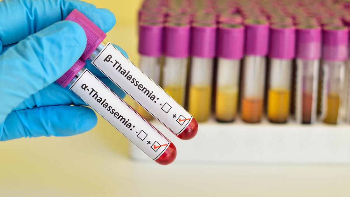 1,000 transplants and new beginnings: Thalassemia patients get a second chance