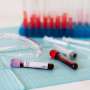 Differences in immune cells predict skin cancer treatment outcomes