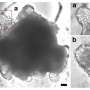 Heart assembloids give researchers a new way to study heart valve disorders