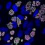 Toxoplasma parasite reveals an unusual strategy for surviving crowded environments in infected cells