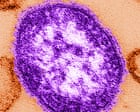Six-week-old child in Pennsylvania died from measles, coroner says