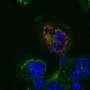 Cells' own abnormal RNA may trigger inflammation during viral infection, challenging 20 years of assumptions