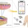 Wearable microneedle patch empowers conventional ultrasound for continuous glucose monitoring