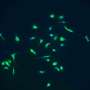 Protein secreted by immune cells may help drive brain aging