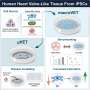 Stem cells create humanlike heart valve tissue to model disease and test treatments