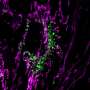 Mitochondrial proteins may trigger inflammation by mimicking bacterial distress signals