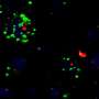 Brain signaling mechanism may explain clozapine weight gain