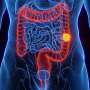 Organized, biennial fecal immunochemical testing-based screening linked to lower colorectal cancer mortality
