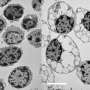 Scientists uncover cellular mechanism driving both rare childhood dementia and Alzheimer's disease