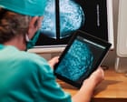 AI will help find cure for cancer ‘within our lifetimes’, says Arm Holdings chief