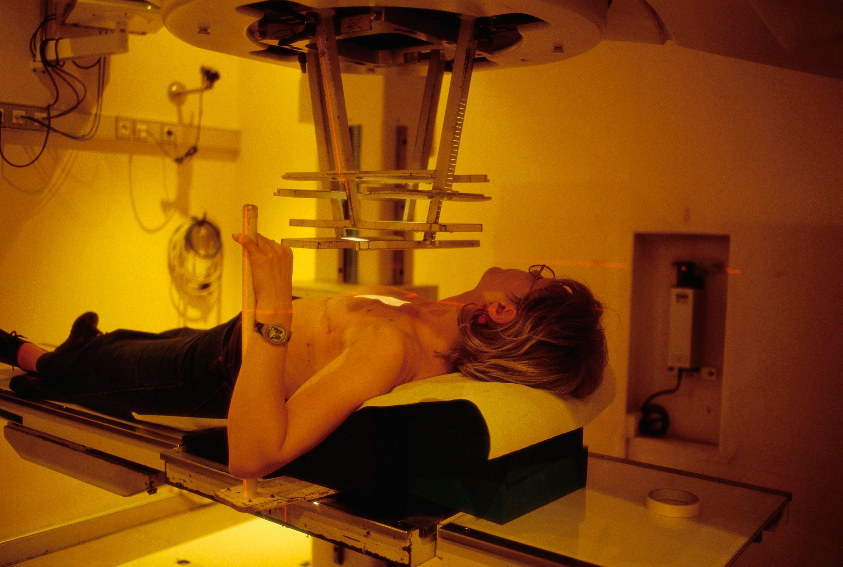 Medicare Will Pay For Radiation. Will It Pay To Know Who Needs It?