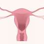 Can removing fallopian tubes really reduce the risk of ovarian cancer?