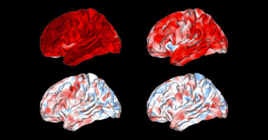 Neuropsychiatric MRI brain signatures fail reproducibility test