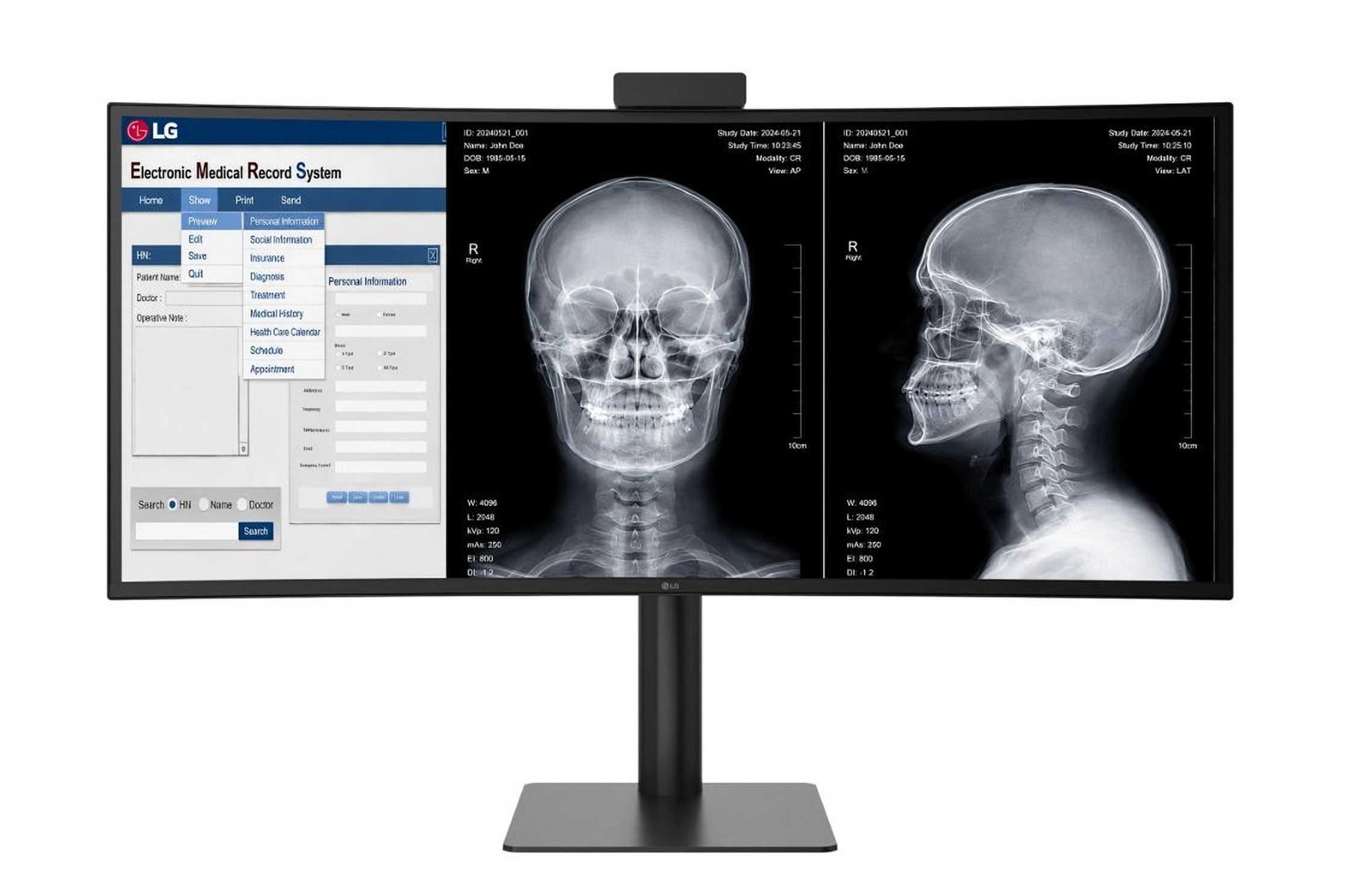 LG expands B2B medical device lineup with FDA-cleared diagnostic monitor