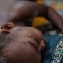 Suspected measles cases kill nearly 1,000 as Bangladesh struggles to contain outbreak