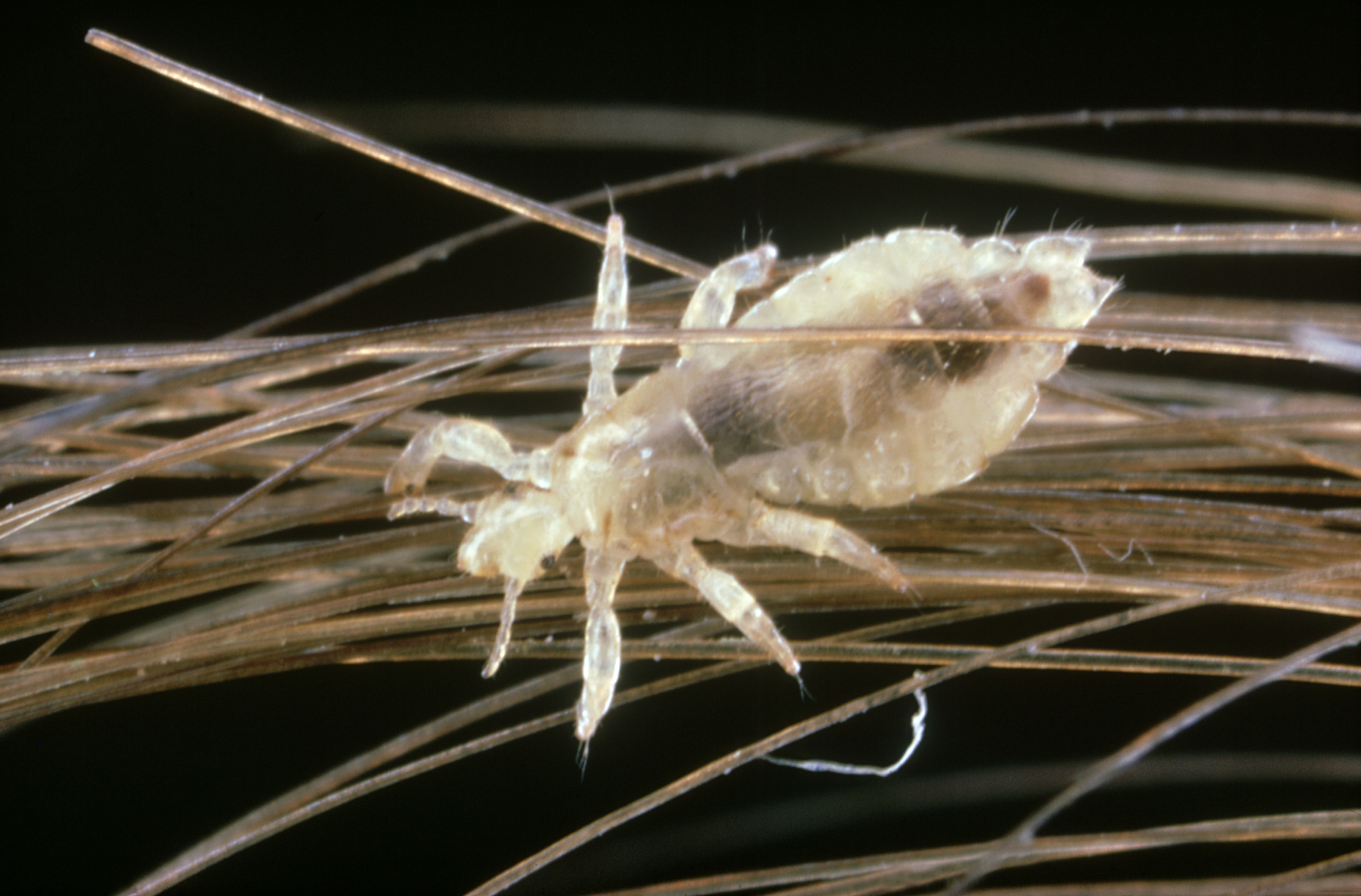 It's Head Lice Season. Here's What to Know