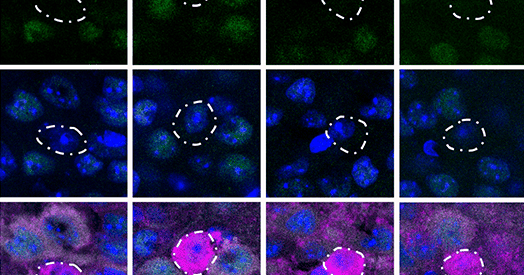Loss of interneuron plasticity may be shared hallmark of neurodevelopmental conditions