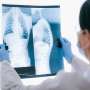 Could salmon and other fatty fish unlock new treatments for severe lung disease?