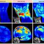 For the tiniest patients, new tech brings clearer MRI images