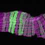 Female gut muscles reshape to meet the demands of reproduction, preclinical study suggests