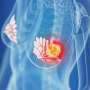Anti-Müllerian hormone predicts benefit of chemo + endocrine therapy in under-55s with breast cancer