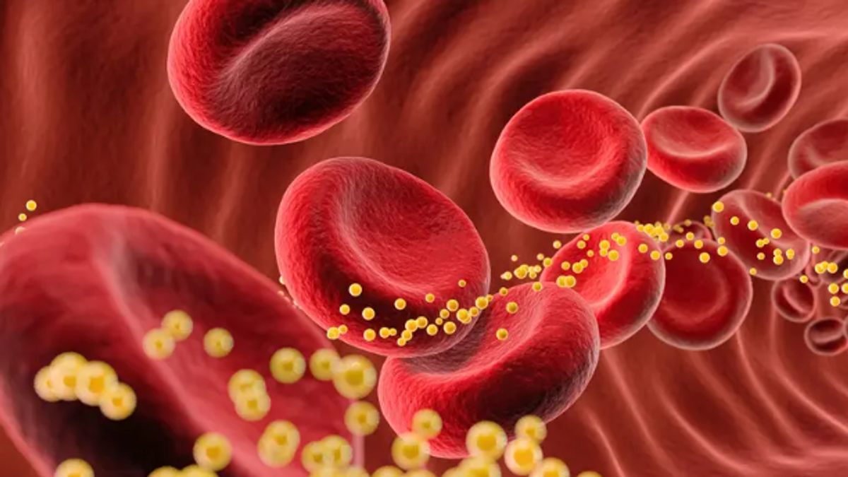 Gene therapy shows promise in halving bad cholesterol levels