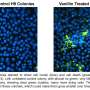 Vanillin flavoring in e-cigarettes disrupt human embryonic stem cell development, lab study finds