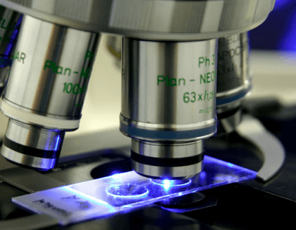 High PSA result does not automatically mean prostate cancer – Laboratory expert