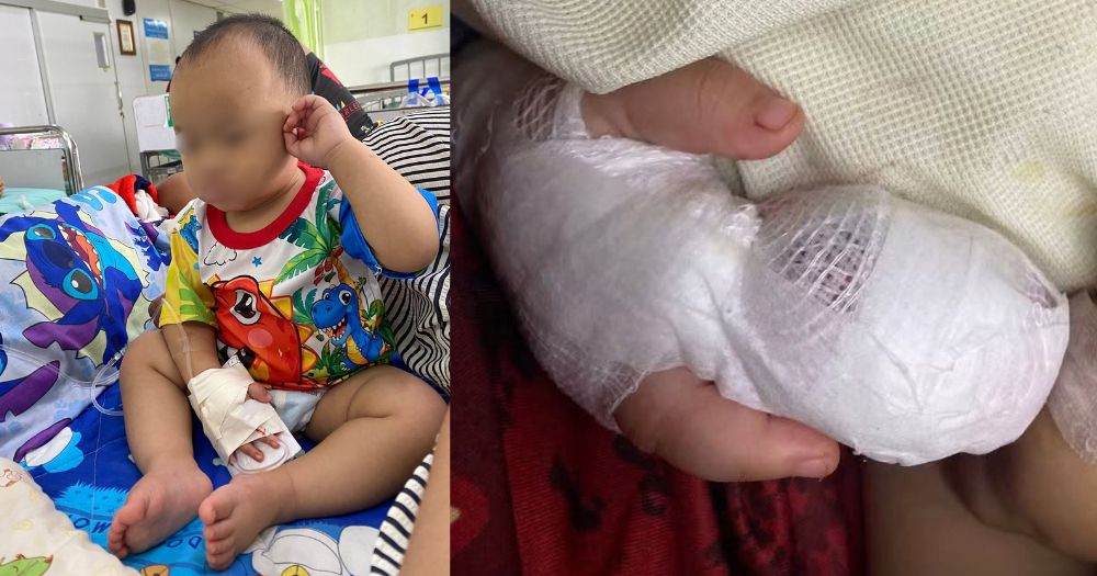Thai hospital apologises after nurse cuts off 1-year-old boy's index finger with scissors