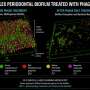 Scientists target gum disease with bacteriophage virus