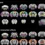 Trauma-induced changes in the brain differ significantly between males and females
