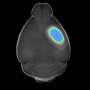 Researchers develop automated MRI system to strengthen stroke treatment studies