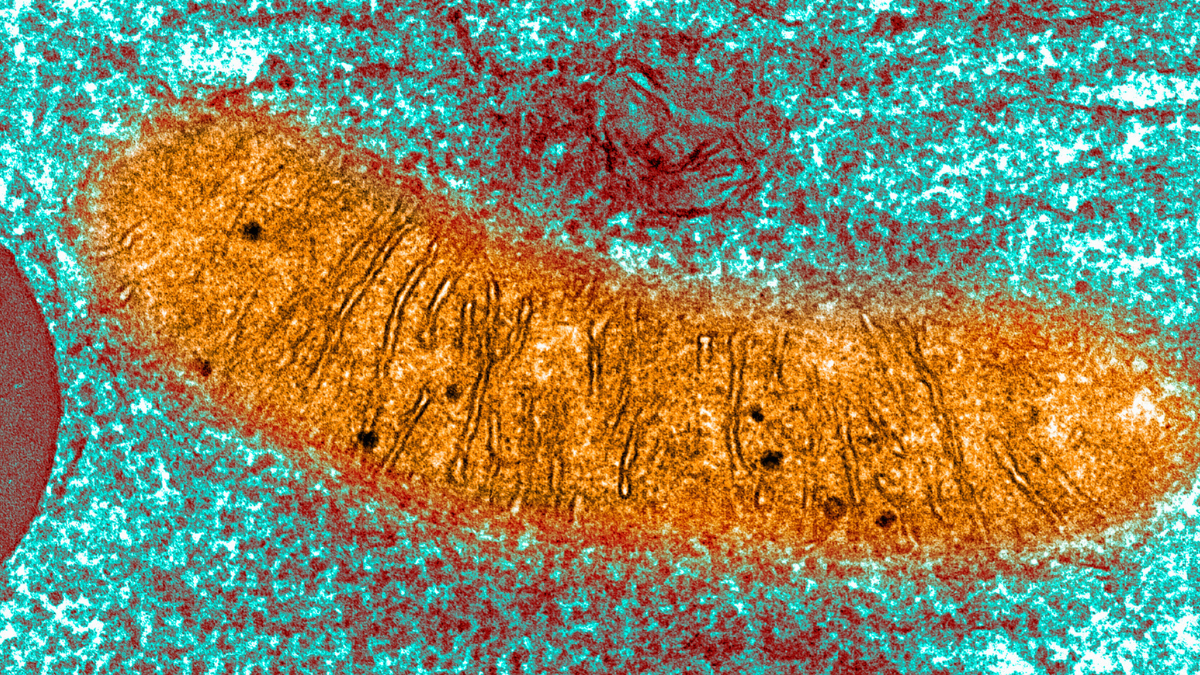 Abnormal New Structure Detected in The Brains Of Humans And Mice With Alzheimer's Disease