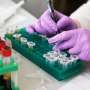 Epstein-Barr virus activity may foreshadow multiple sclerosis attacks