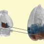 New brain map connects mice and primates to strengthen medical research
