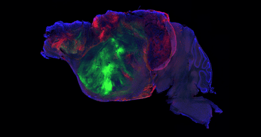 Human brain organoids flourish in emptied mouse cortex