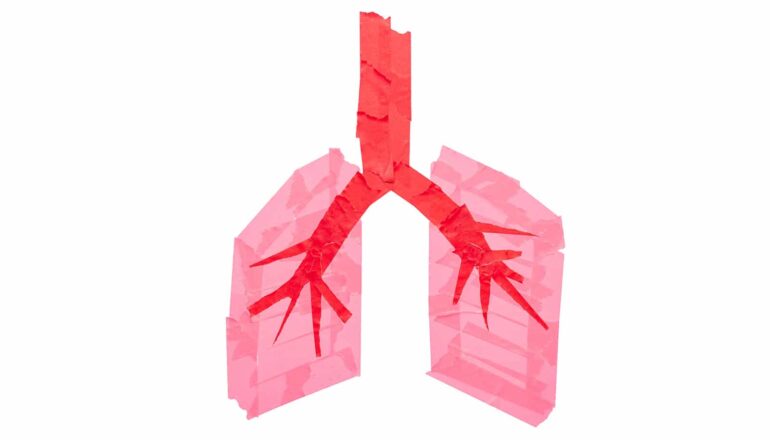 New approach shows promise in fighting lung cancer