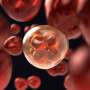 Machine learning system can identify cancer cells based on how they scatter light