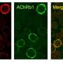 CAAR T-cell therapy offers a more targeted route for neurological autoimmune diseases